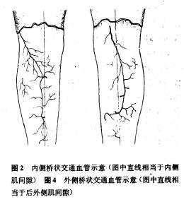 小腿桥状交通皮动脉血管 小腿桥状交通皮动脉血管