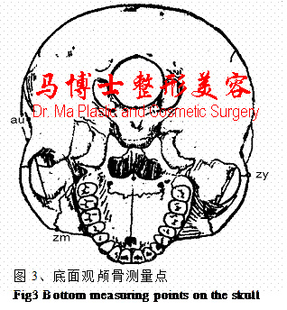 颌面骨底面骨性测量点 颌面骨底面骨性测量点