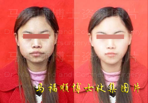 整形照片真伪 整形照片真伪
